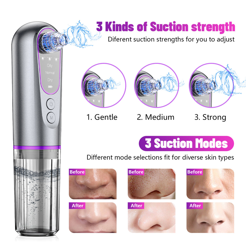 Electronic Blackhead Remover