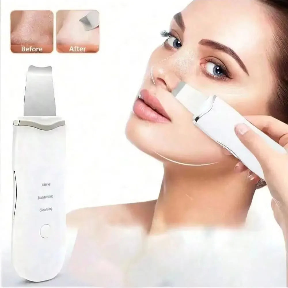 2026 Blackhead Remover Pimple Acne Removal Blackhead Vacuum Tool Skin Care Pore Cleaner Rechargeable