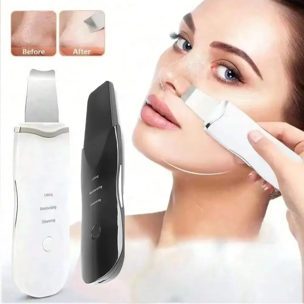 2026 Blackhead Remover Pimple Acne Removal Blackhead Vacuum Tool Skin Care Pore Cleaner Rechargeable