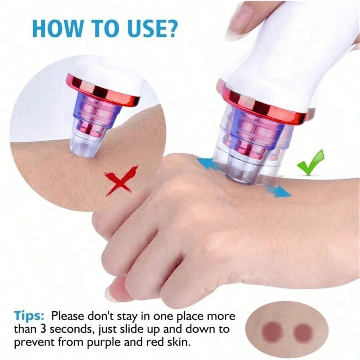 2026 Blackhead Remover Pimple Acne Removal Blackhead Vacuum Tool Skin Care Pore Cleaner Rechargeable