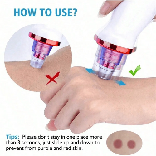 2026 Blackhead Remover Pimple Acne Removal Blackhead Vacuum Tool Skin Care Pore Cleaner Rechargeable